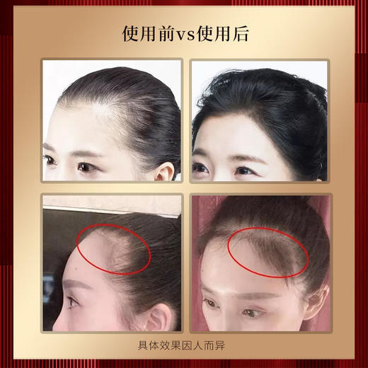 第二代魅赞专业防掉固发去屑止痒高端姜王洗发水 商品图4