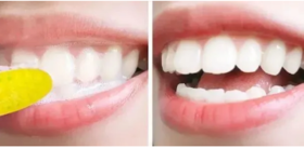  牙黄口臭超尴尬！用它3秒去除口臭，2周变白，比洗牙还管用！ 