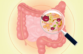  胃肠癌的早期信号早知道能救命！医生：尤其是这5类人要更加警惕~ 