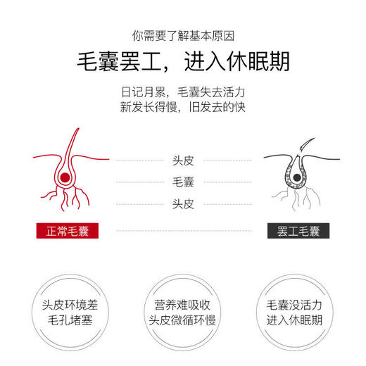 买一送一【荣获育发类国妆特证】特证育发液悦瑾防脱育发液秃头克星草本养发育发捍卫您的发际线！ 商品图2