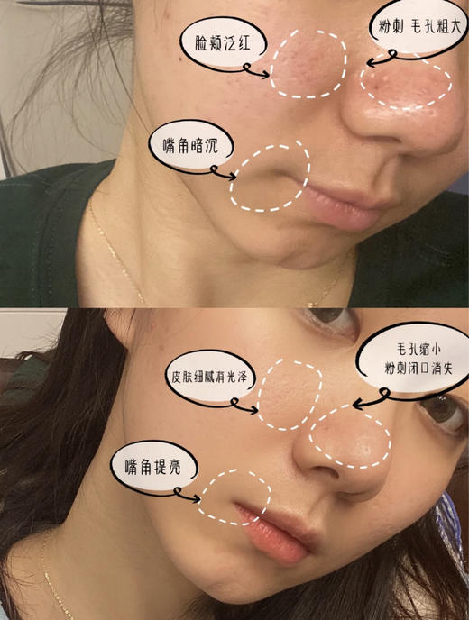 价值840 3瓶装 二代兰蔻极光水50ml 控油焕肤去闭口 抛光美白 商品图3