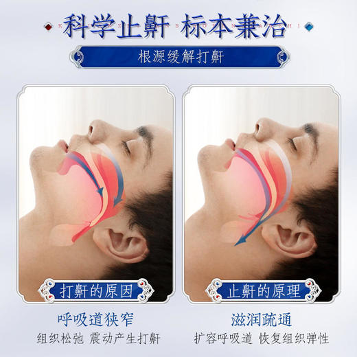 【睡前一喷整晚无鼾】国药集团天目湖苗古汤医用液体敷料止鼾喷剂草本植萃修护组织弹性温和止鼾型辅助情绪告别打呼噜 商品图2