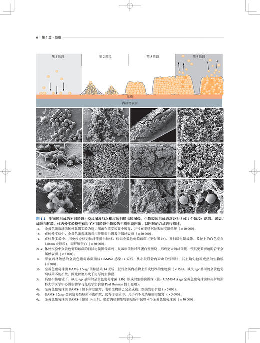 AO骨感染治疗原则 高秋明 主译 医源性感染临床医学外科学骨科 肌肉骨骼系统感染治疗 上海科学技术出版社9787547850015 商品图4