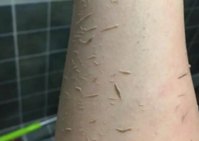 从你身上搓出来的“泥”到底是什么？ 