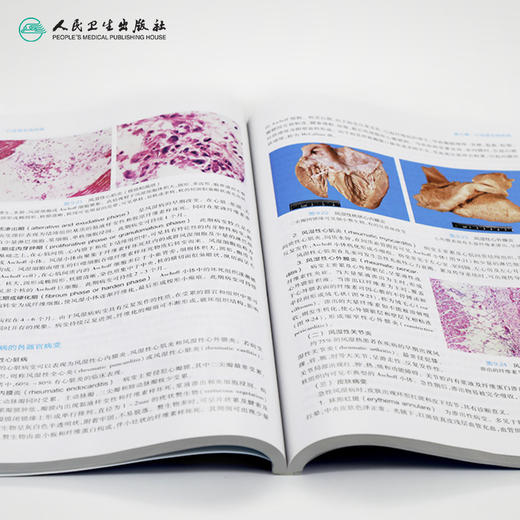 病理学第9九版 人卫十三五本科规划教材西医临床医学第九轮五年病理学外科学诊断学药理学传染病学全套图书人民卫生出版社考研教材 商品图4