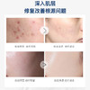 【第二支半价】 乐敦暗疮膏祛痘膏 去印膏 一套 修护青春痘清爽不油腻 商品缩略图1