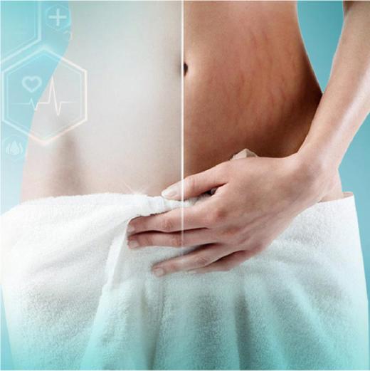 三选一（孕期皮肤管理、） 商品图2