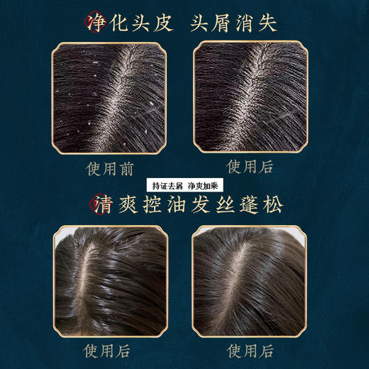 敷本生姜防脱生发洗发水去屑控油蓬松洗发露止痒改善发质男女士 商品图3