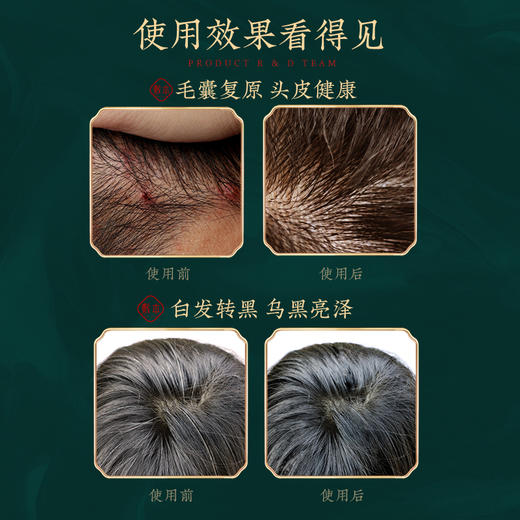 敷本人参头皮奢养套装强根韧发控油蓬松固本调养净澈 商品图4