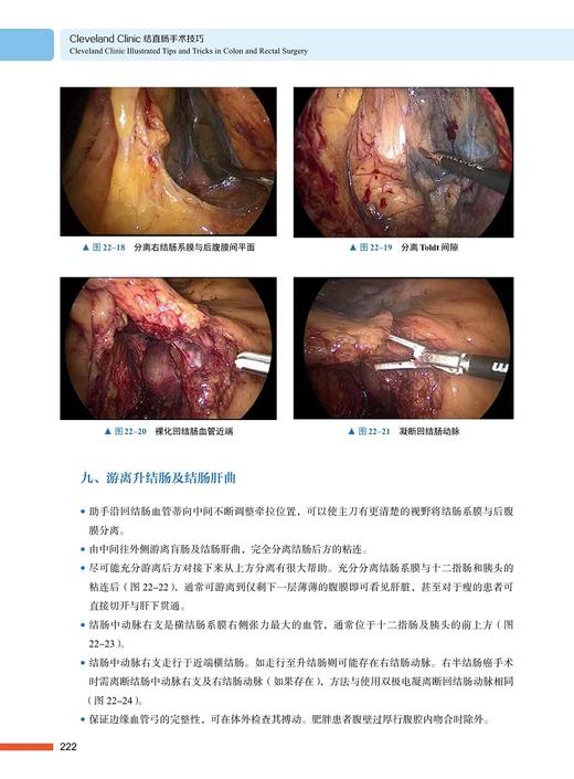 Cleveland Clinic 结直肠手术技巧 斯科特·R.斯蒂尔 著 肛肠外科学书籍盆底腹部手术围术期经验 中国科学技术出版社9787504692429 商品图4