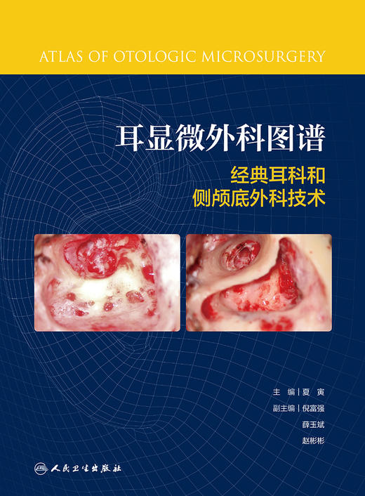 耳显微外科图谱  2022年1月参考书 商品图1