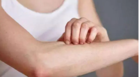 艾灸后奇痒难耐，红肿一片？不用担心，这是艾灸在身体里起作用了！ 