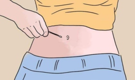 肚脐到底能不能抠？困扰你多年的问题有答案了 