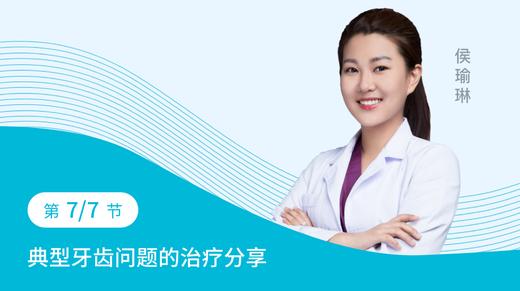 第七节： 典型牙齿问题的治疗分享 商品图0