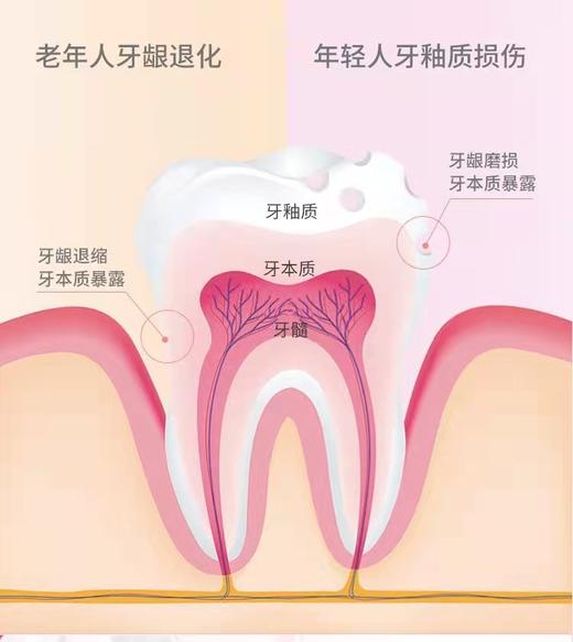 【肖战同款】舒客敏感护理牙膏175g 2支装 冷热酸甜不刺痛（新旧包装随机发货） 商品图5