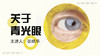 七、青光眼能治愈吗？ 商品缩略图0