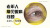 老年人常见眼科问题 商品缩略图0