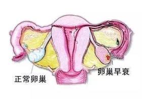  没想到熬夜、节食的危害，居然还有卵巢早衰…… 