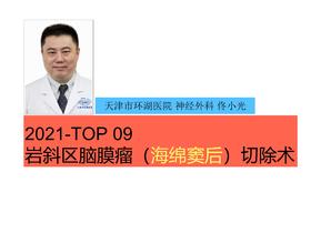 2021Top9 岩斜区脑膜瘤（海绵窦后）切除术