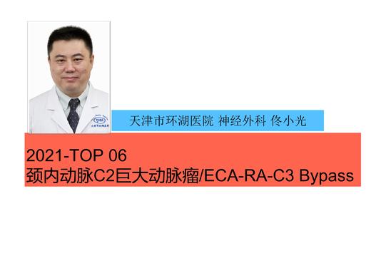2021Top6 颈内动脉(C3)巨大动脉瘤/ECA-RA- C3Bypass 商品图0