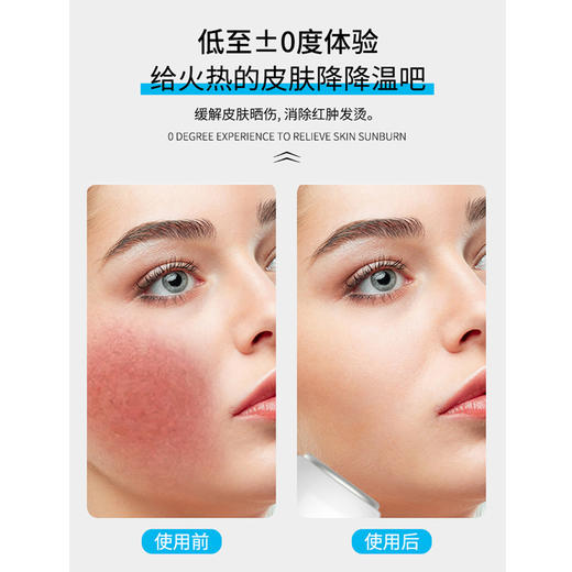 【限时折扣】面部小冰锤降温冰肌美容仪（粉)(蓝） 商品图2