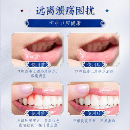 【买2送1 买3送2】苗古汤液体敷料口腔溃疡喷雾 口腔烦恼 一喷就好 商品图1