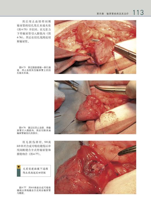 小动物后腹部手术（世界兽医经典著作译丛•小动物外科系列） 商品图6