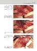 小动物后腹部手术（世界兽医经典著作译丛•小动物外科系列） 商品缩略图4