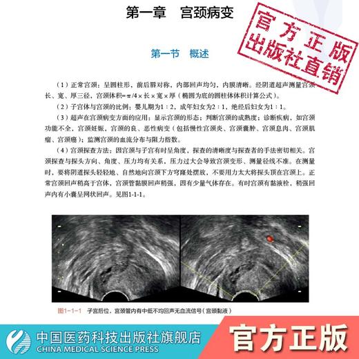 实用妇科盆底与超声 中国医药科技出版社 商品图1