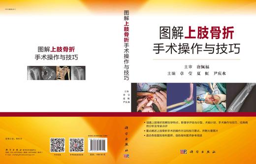 图解上肢骨折手术操作与技巧   主编：章莹 夏虹 尹庆水  科学出版 商品图2