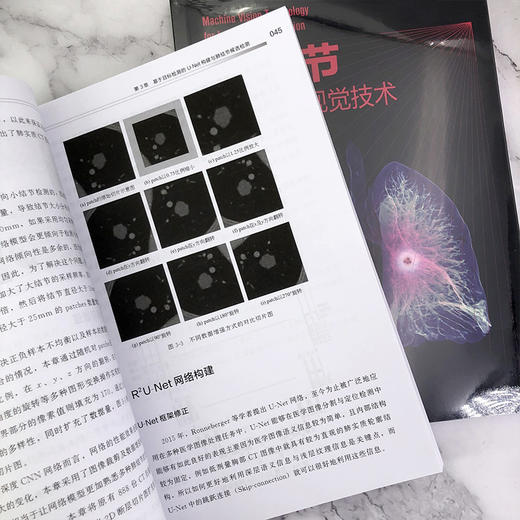肺结节检测机器视觉技术 商品图6