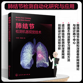 肺结节检测机器视觉技术