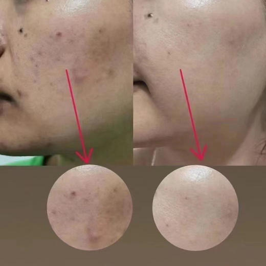 贝悦容珍珠膏10g 商品图3