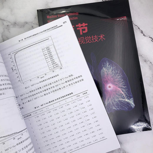 肺结节检测机器视觉技术 商品图5