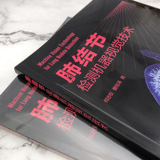 肺结节检测机器视觉技术 商品图2