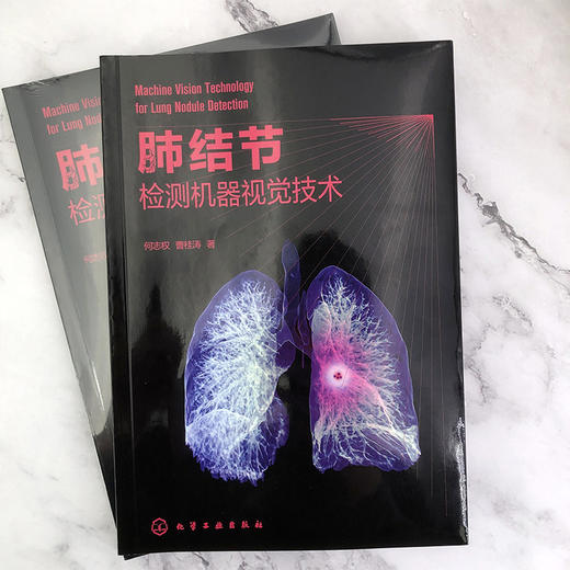 肺结节检测机器视觉技术 商品图1