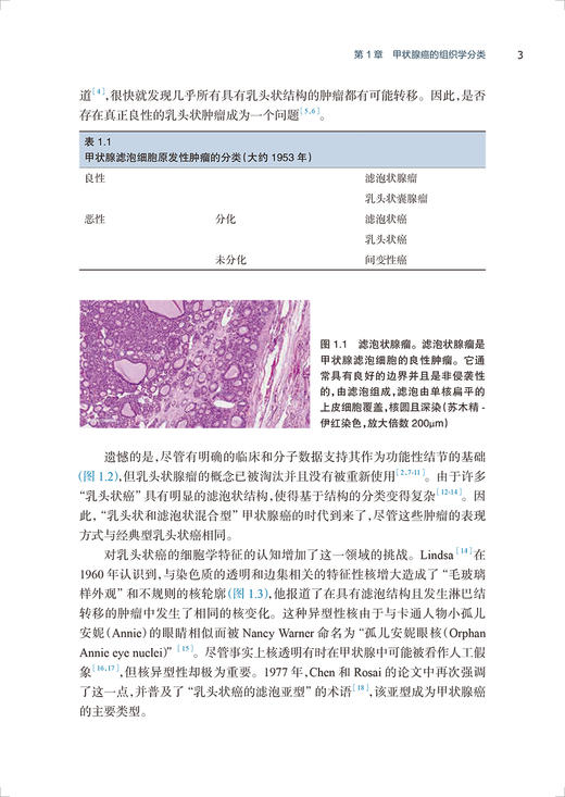 甲状腺癌 邢明照 主编 癌症肿瘤学书籍 甲状腺手术药物治疗 内窥镜美容手术分层甲状腺激素抑制 人民卫生出版社9787117326117 商品图4