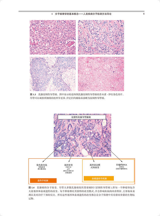 疾病分子诊断学 分子检测应用指南 苏东明 梁莉 等编 疾病监测诊断 遗传性疾病传染性疾病肿瘤 人民卫生出版社9787117324236 商品图4