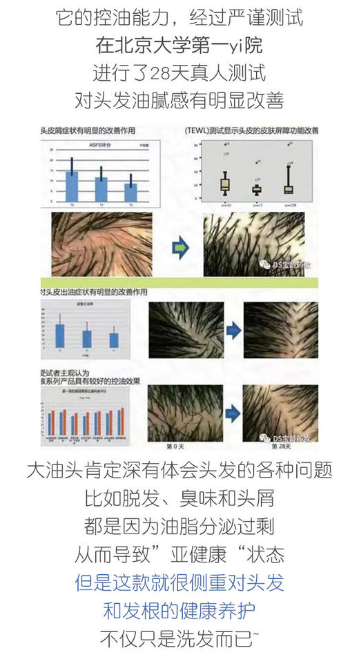 宝龄洗发水头皮发根洁净液300ml大瓶性价比高中药成分防脱医院款何首乌 商品图8