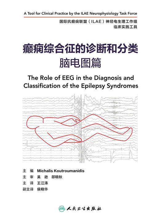 癫痫综合征的诊断和分类 脑电图篇 翻译版 癫痫发作症状术语 脑电图阵发性异常及伴随的发作性事件 王江涛 主译9787117325677 商品图2