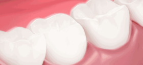 牙齿好看的人到底能多省钱？选对口腔产品，告别牙黄、口臭、牙龈肿痛！ 