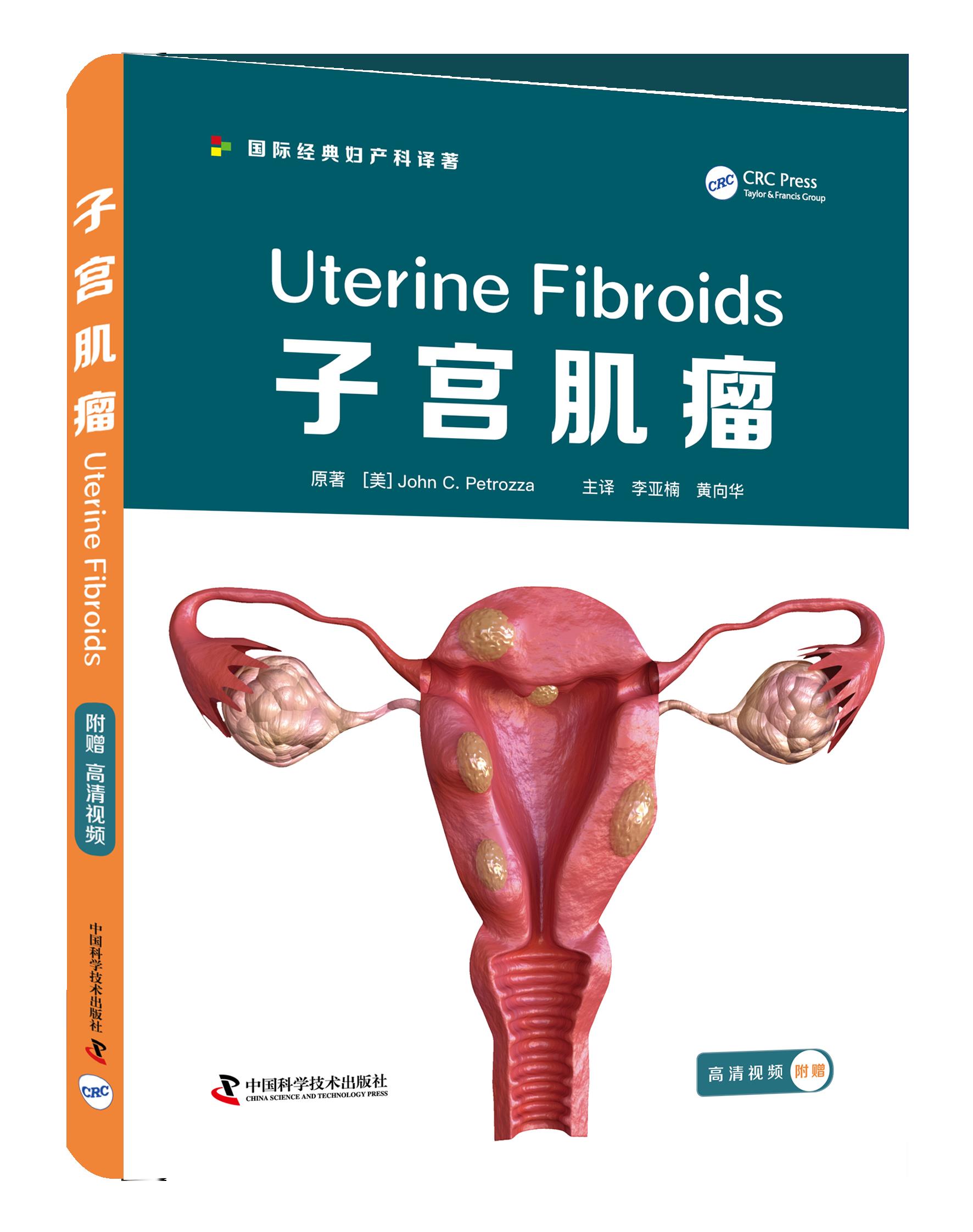 子宫肌瘤  结合临床实际，紧贴医患共同关注的子宫肌瘤问题