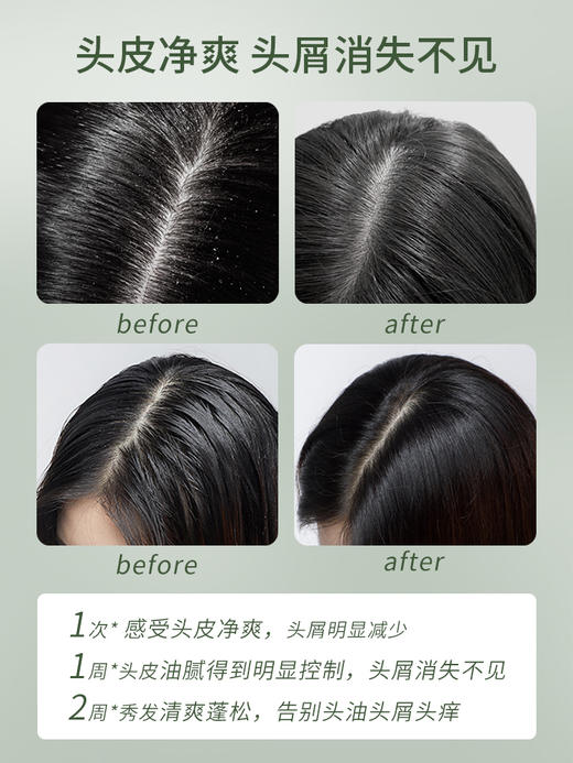 【桉树 · 去屑】FicceCode桉树洗发水300ml 桉树发膜 去屑净爽120H控菌 商品图3