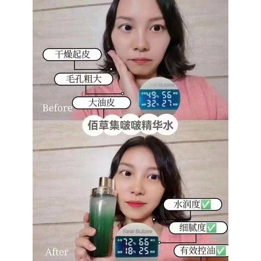 佰草集太极肌源修护啵啵精华水 商品图3