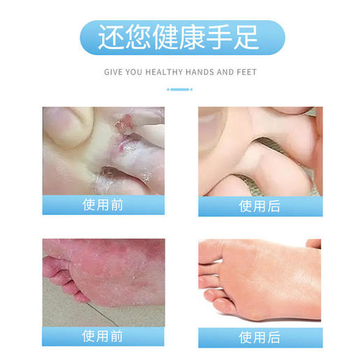 【还你健康手足】白云山手足通用型jiao气喷雾医用液体敷料快速止痒滋养修护草本配方温和 商品图3