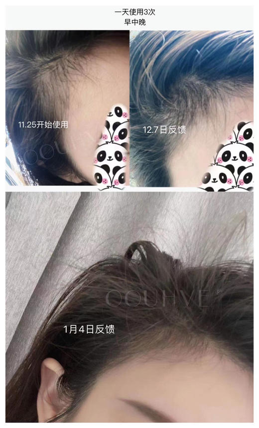 5折清仓(8月到期，不开封可延长2年)头皮抗老产后脱发拯救发际线日进口北海道生发液头皮护理精华增长睫毛眉毛20ml 商品图7