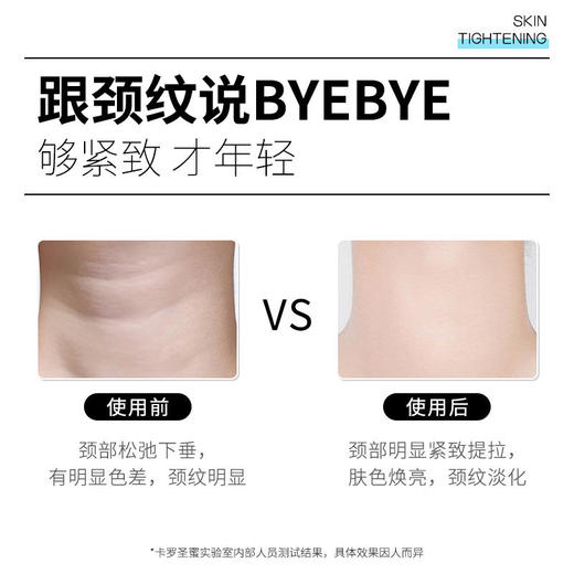 【卡罗圣蜜颈纹小熨斗】淡化颈纹紧致下颌线柔滑细腻焕亮肤色多方位呵护实力淡颈纹弹力亲肤冰感呵护小巧便携柔滑紧致颈膜一膜全部解决 商品图2