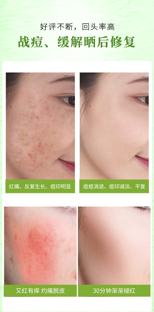 Nature Republic自然乐园自然共和国祛痘芦荟胶晒后修护  300ml 商品图7