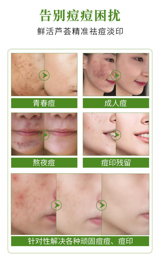 Nature Republic自然乐园自然共和国祛痘芦荟胶晒后修护  300ml 商品图2