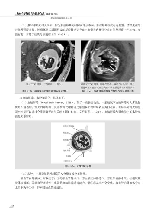 神经影像征象解析肿瘤篇 医学影像联盟经典丛书 王宇军 郑学军 李建业 主编 神经系统临床诊断 科学技术文献出版社9787518985142 商品图4